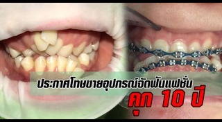 จัดฟันเถื่อน