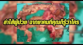 สมุนไพรรักษามะเร็ง