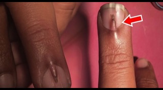 ร่างกายผิดปกติ