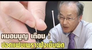 ฝังเข็ม