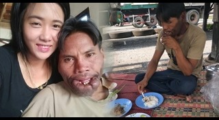 ศัลยกรรมปาก