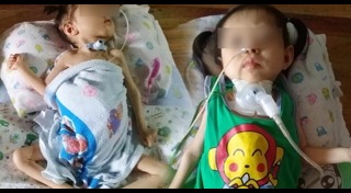 หัวใจพิการแต่กำเนิด