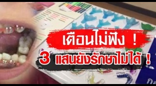 จัดฟันเถื่อน