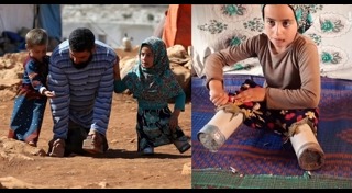 ช้างพิการ