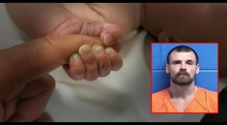 ฝังทั้งเป็น