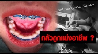 จัดฟันเถื่อน