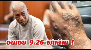 มะเร็งต่อมน้ำเหลือง