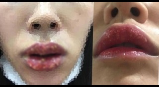 ศัลยกรรมปาก