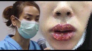 ศัลยกรรมปาก