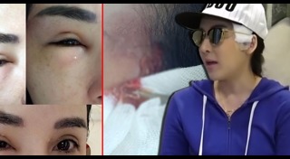 สารสเตียรอยด์