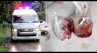 พิษสุนัขบ้า