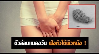 หนอนแมลงวัน