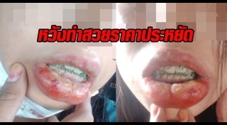 จัดฟันเถื่อน