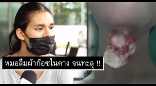 เสริมคาง