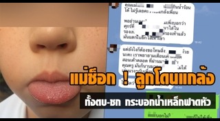 เด็กถูกเพื่อนแกล้ง