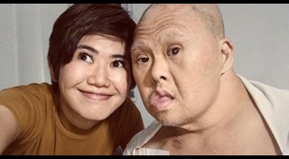 ดาวน์ซินโดรม