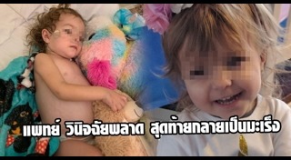 มะเร็งรังไข่