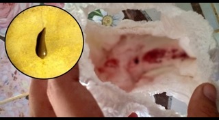 เลือดออกช่องคลอด