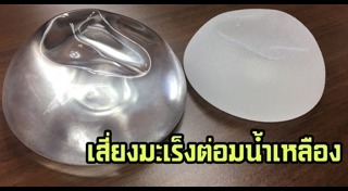 เสริมหน้าอก