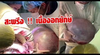 รังไข่