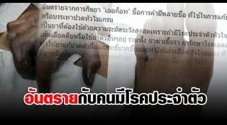 อันตรายจากการใช้ยา