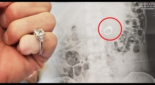 นอนละเมอ