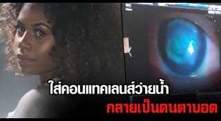 คอนแทคเลนส์