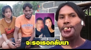 ศัลยกรรมปาก