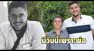 ดาวน์ซินโดรม