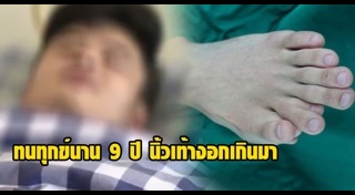 นิ้วผิดปกติ