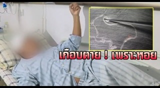 พยาธิในสมอง