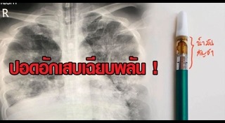 น้ำมันกัญชา