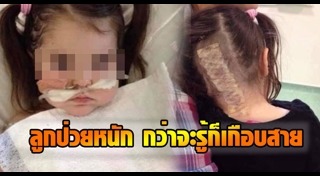 เนื้องอกในสมอง