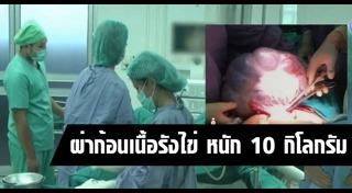 มะเร็งรังไข่