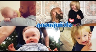 ดาวน์ซินโดรม