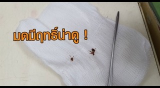 ก้างปลาติดคอ