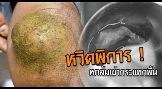 หัวเข่า