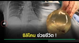 ซิลิโคนเหลว