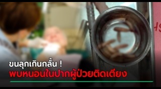 หนอนในปากคน