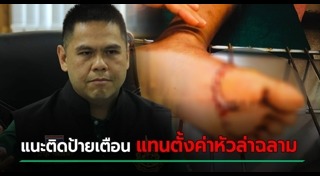 ฉลามกัดคน