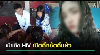 เชื้อ HIV