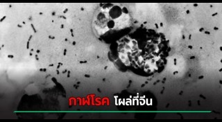 กาฬโรค