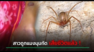 แมงมุมกัด