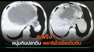 กินอาหารสุกๆดิบๆ