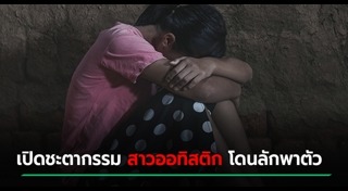 ดาวน์ซินโดรม