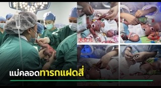 ลูกแฝด