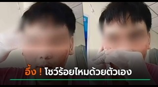 ร้อยไหม