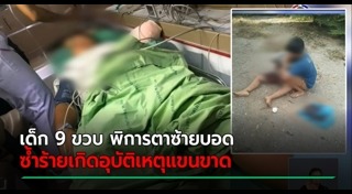 เด็กพิการ