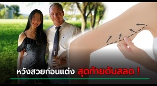 ดูดไขมัน