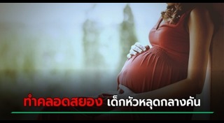 แพทย์ทำคลอด